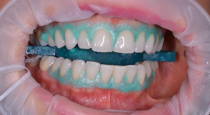 بلیچینگ آفیس