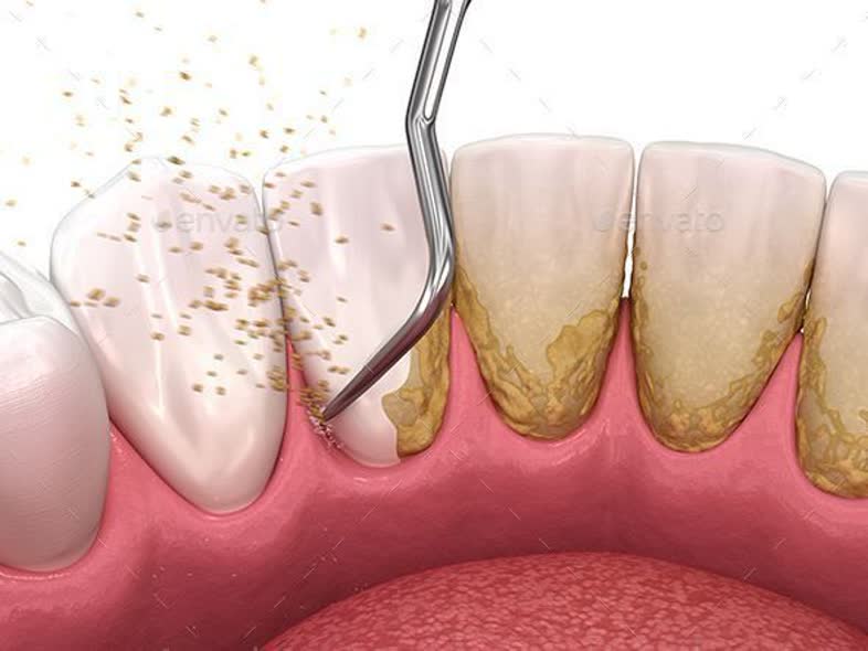 جرمگیری،ضرر جرمگیری